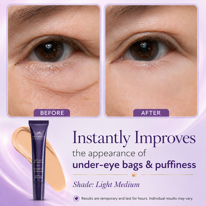 Westmonth™ 60-Second Eye Lift