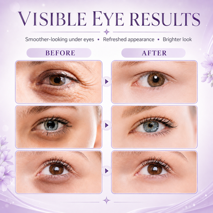 Westmonth™ 60-Second Eye Lift